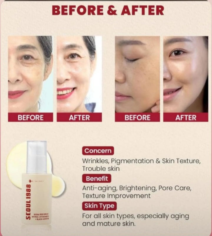 SEOUL 1988 Eye Cream